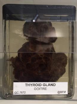 THYROID GLAND